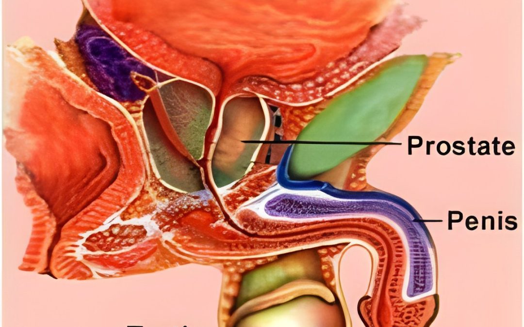 You are what you eat: Low fat diet with fish oil slowed growth of human prostate cancer cells