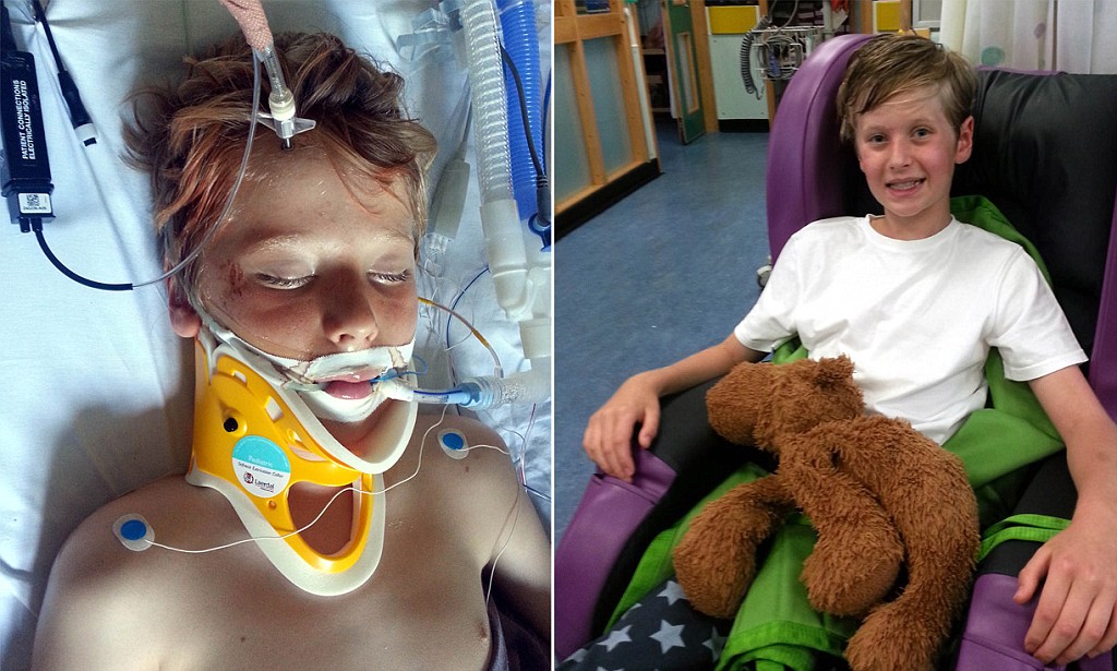 Appeal after boy suffers head injuries